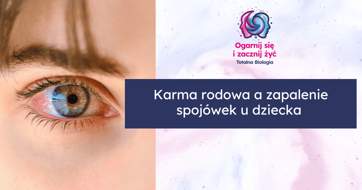 Karma rodowa a zapalenie spojówek u dziecka