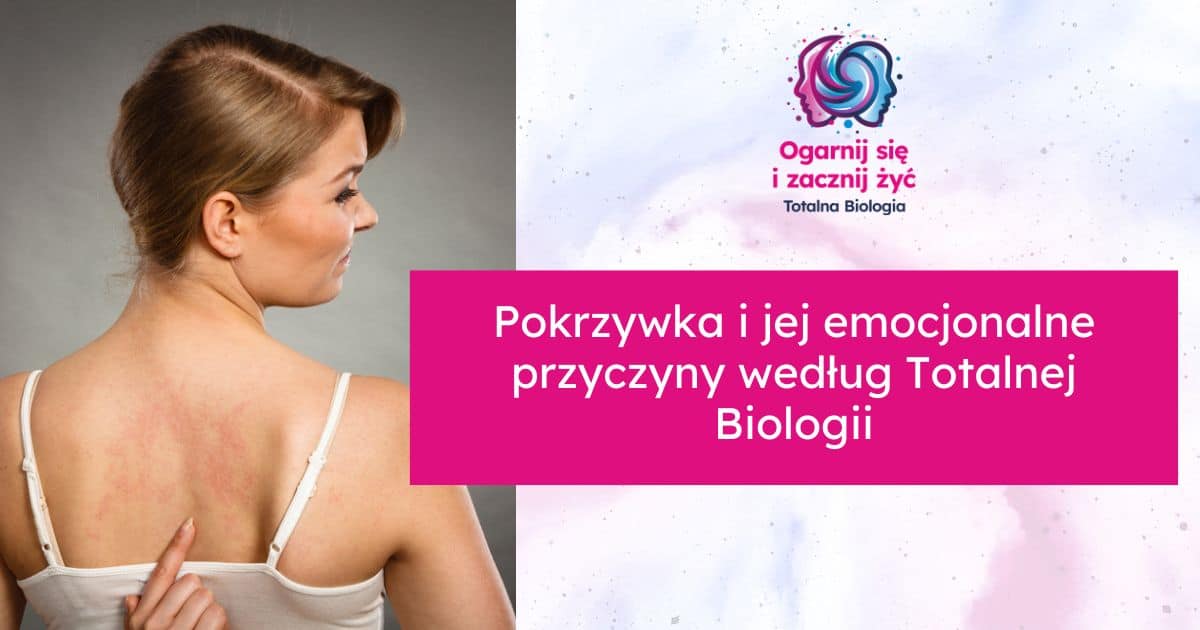 pokrzywka na ciele a totalna biologia