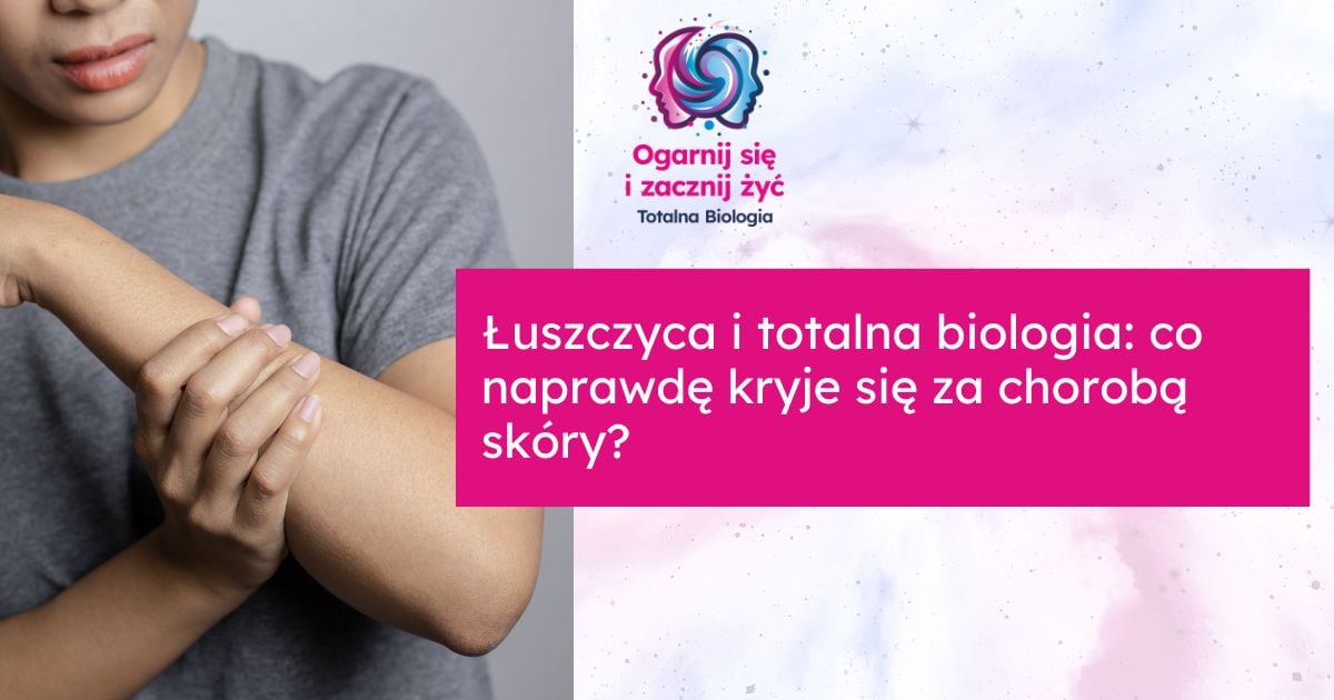 Pomoc w leczeniu łuszczycy, holistyczne podejście, kursy i warsztaty Totalna Biologia.